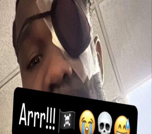 艾顿眼部受伤不忘晒自拍！雷迪克赛后调侃：他看着就像个海盗