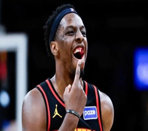 被打掉兩顆牙！老鷹官宣奧孔古成功手術(shù)缺席對(duì)陣火箭步行者兩場(chǎng)