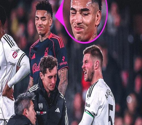 富勒姆后衛(wèi)安諾生比賽中手指脫臼，隊醫(yī)給他復(fù)位時他都不敢看