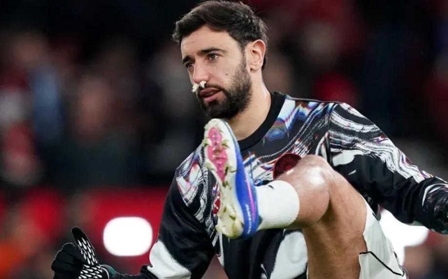 赛前被队友暴击，热身时B费被利马的一脚传球砸到流鼻血