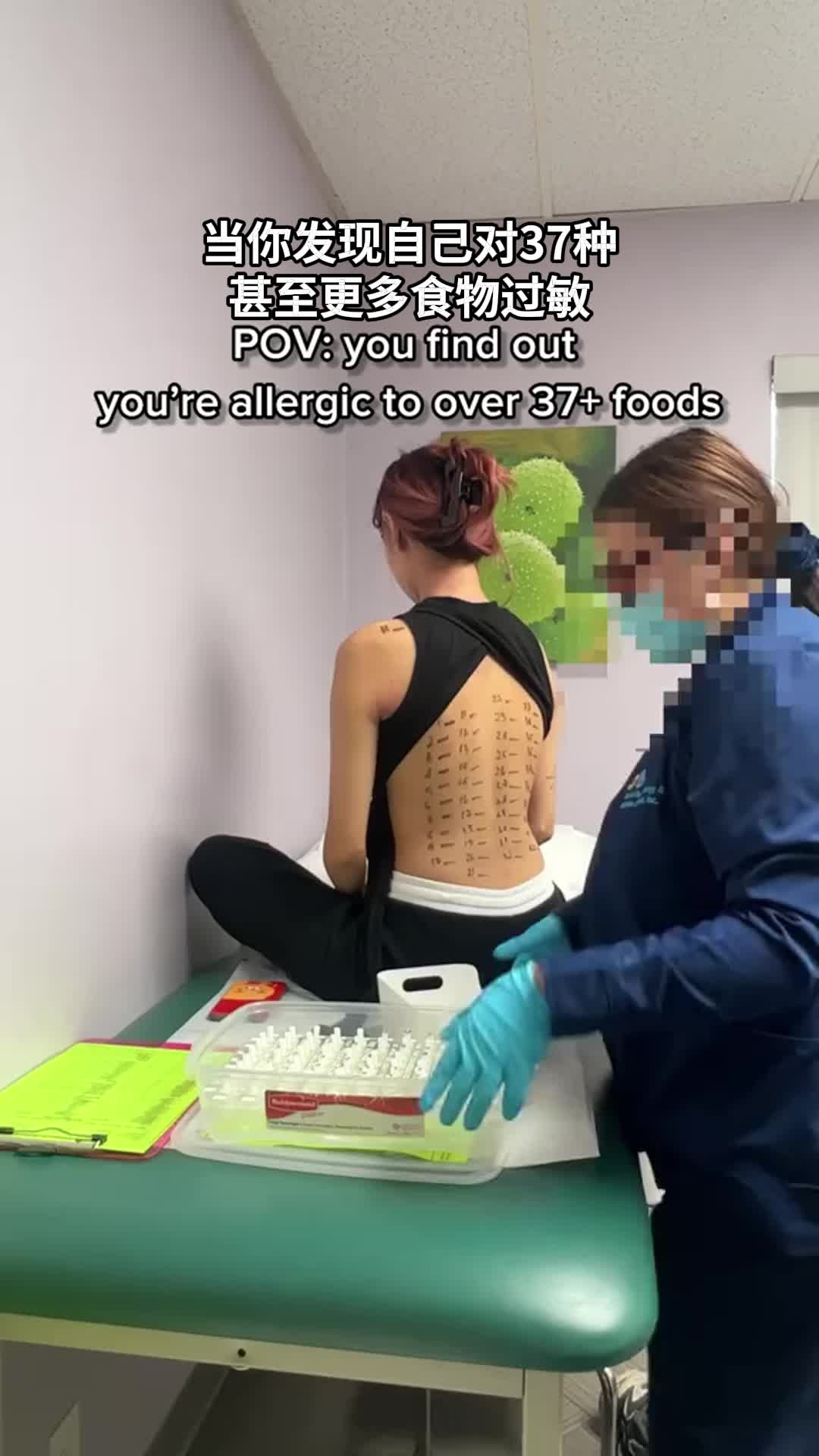 37种过敏原国外妹子做了个过敏原测试,结果满背都是包!