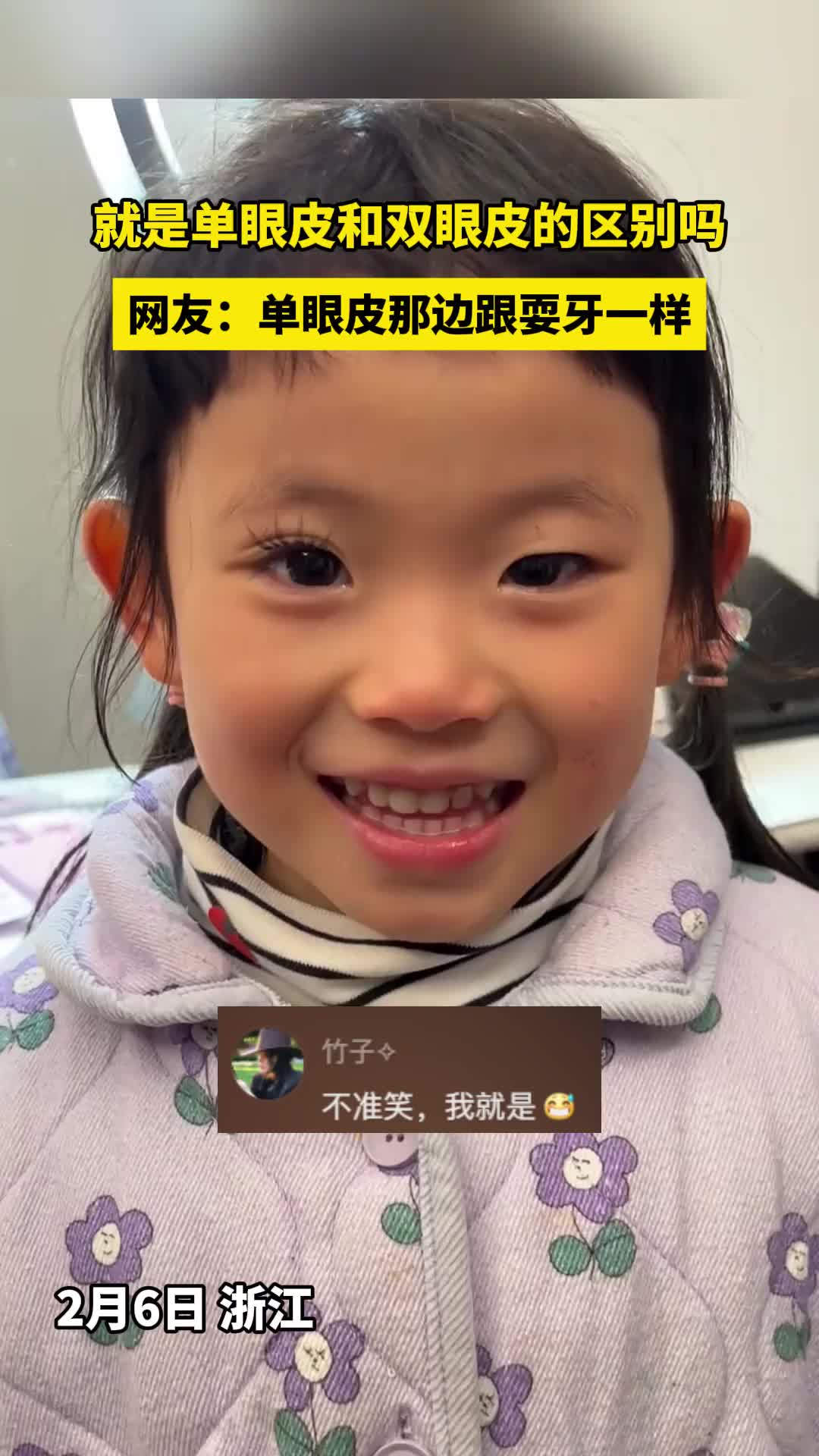 就是单眼皮和双眼皮的区别吗网友:还是双眼皮显眼大