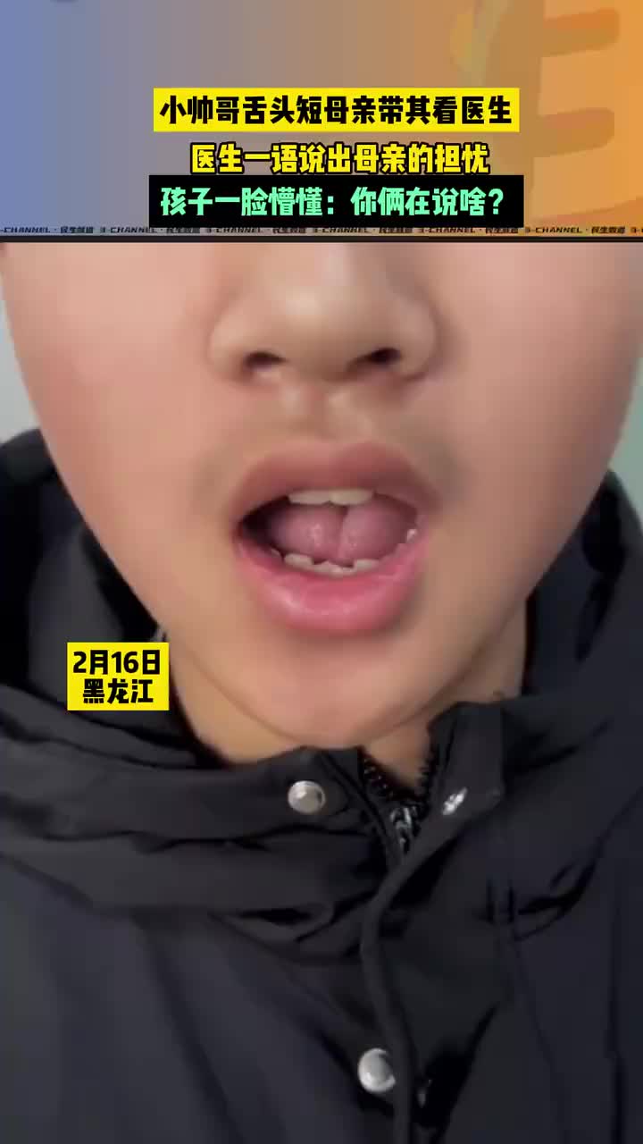 男孩舌头短母亲带其看医生,大夫一语说出母亲的担忧!