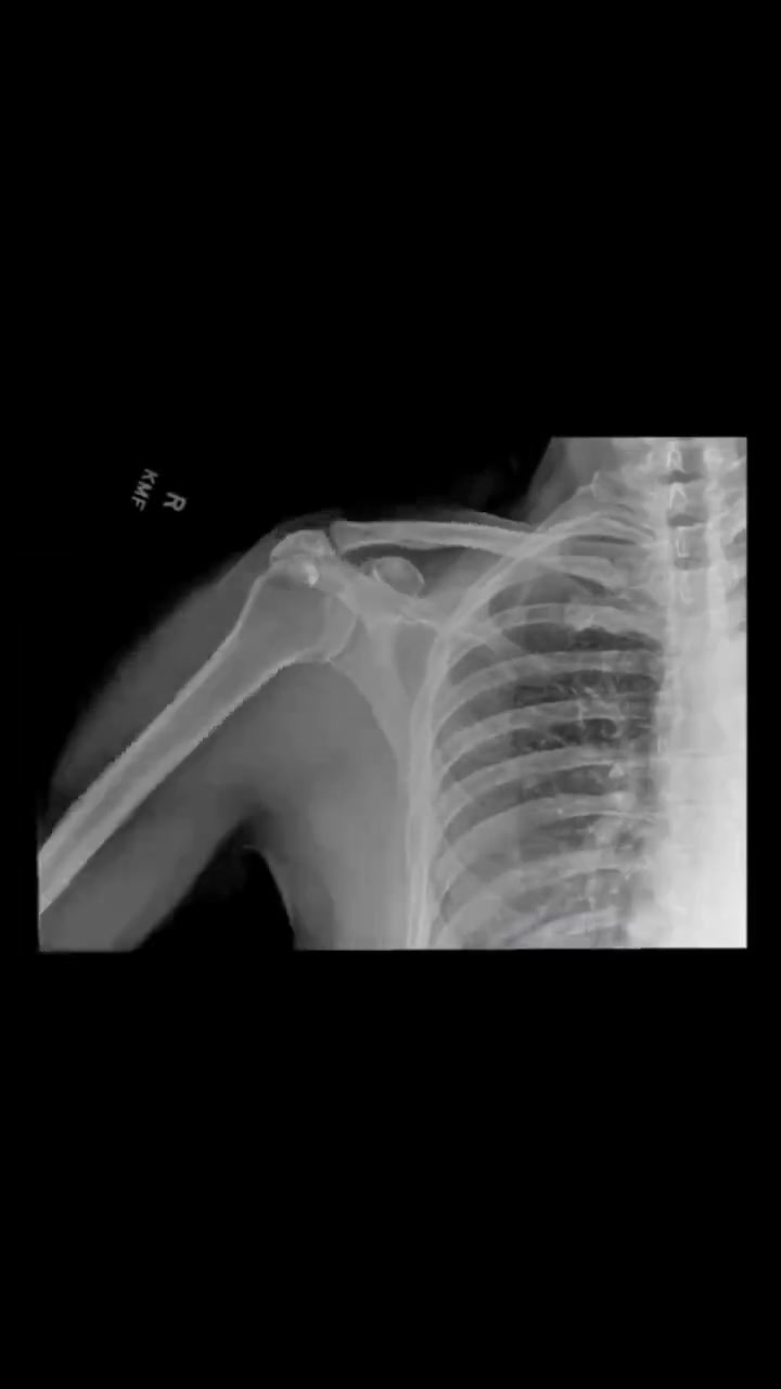 真正的露骨了!在X光下观察人体运动!!