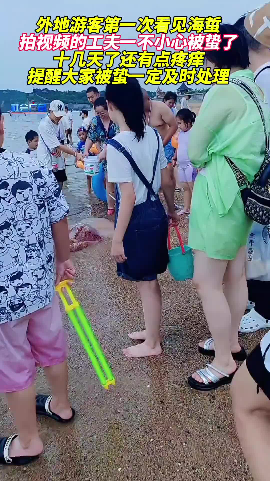外地游客第一次见到海蜇,不小心被蛰到