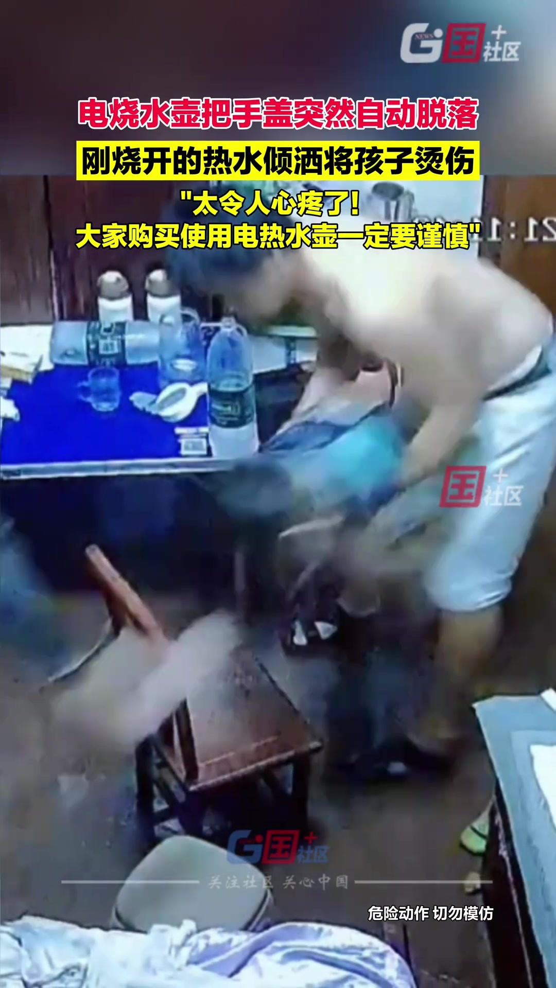 电烧水壶把手盖突然自动脱落刚烧开的热水倾洒将孩子腿部烫伤