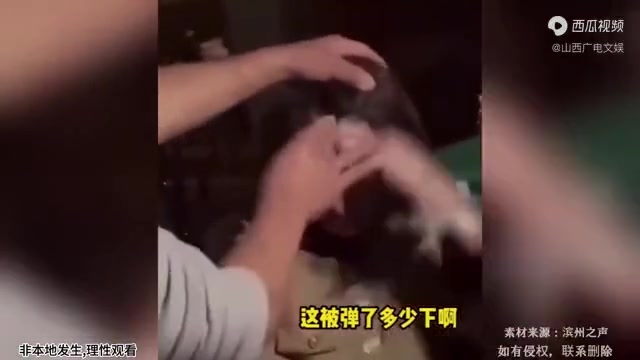 女子和朋友玩游戏输掉额头被弹出多个大包这样弹法也是狠