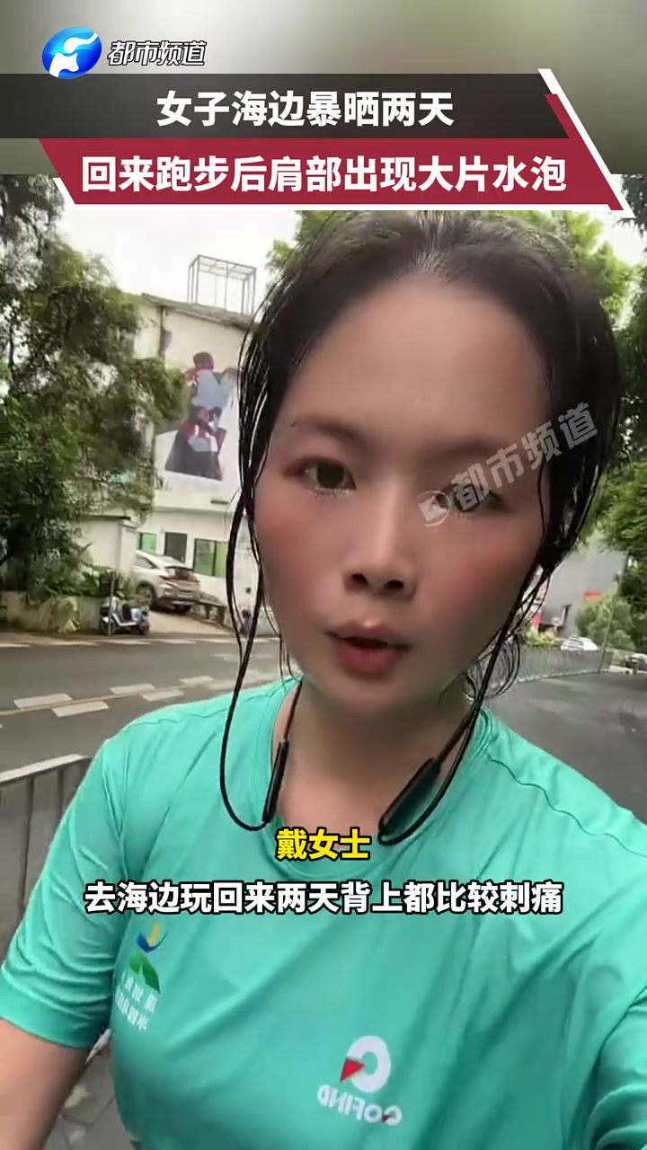 女子海边暴晒两天晒伤,跑步后发现肩膀全是水泡