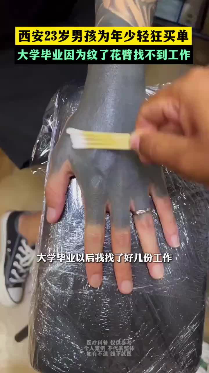 为年少轻狂买单!因年轻跟风觉得“纹身很酷”现在很后悔