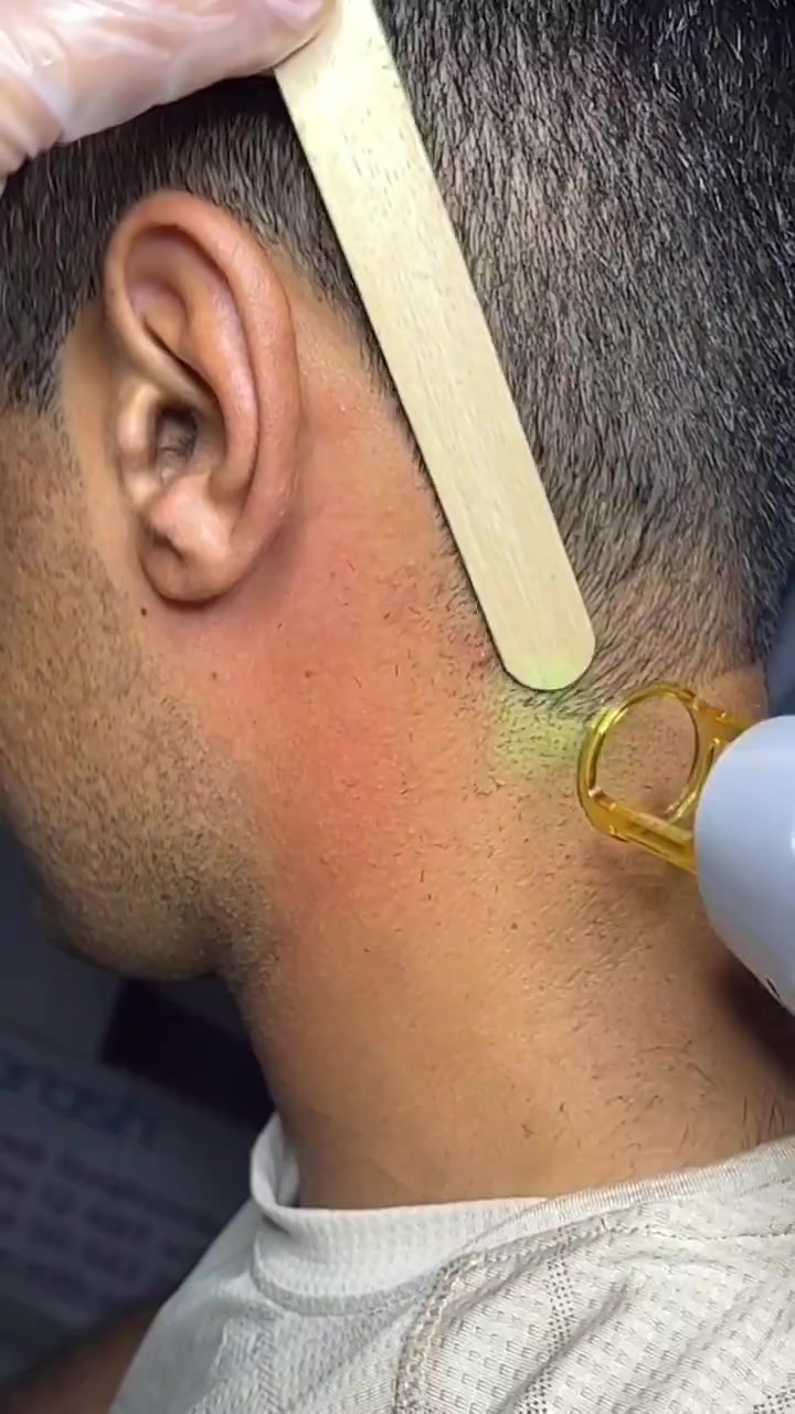 激光理发修边,其他没啥,就是感觉有点儿费头!