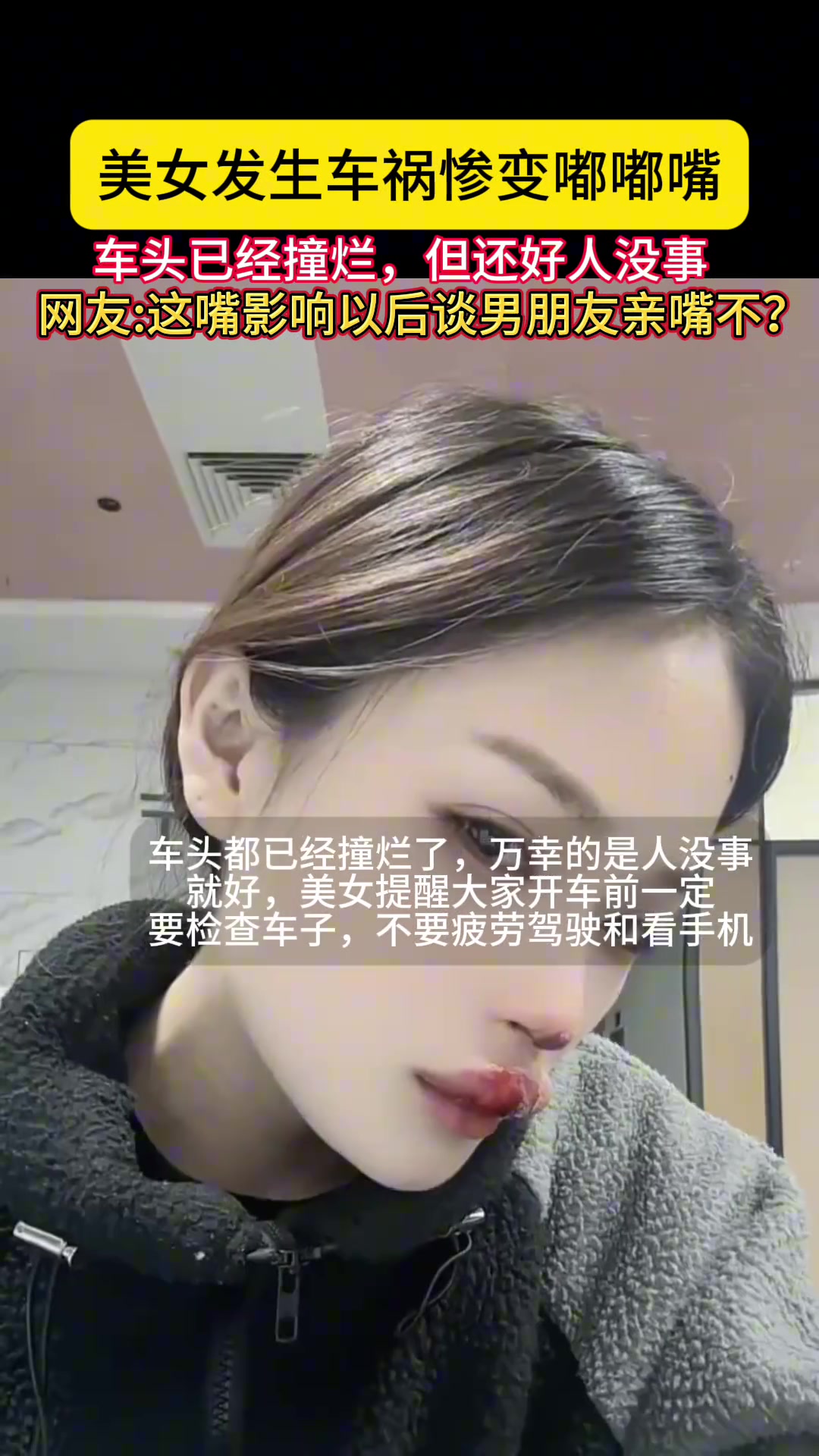 女子车祸后惨变嘟嘟嘴