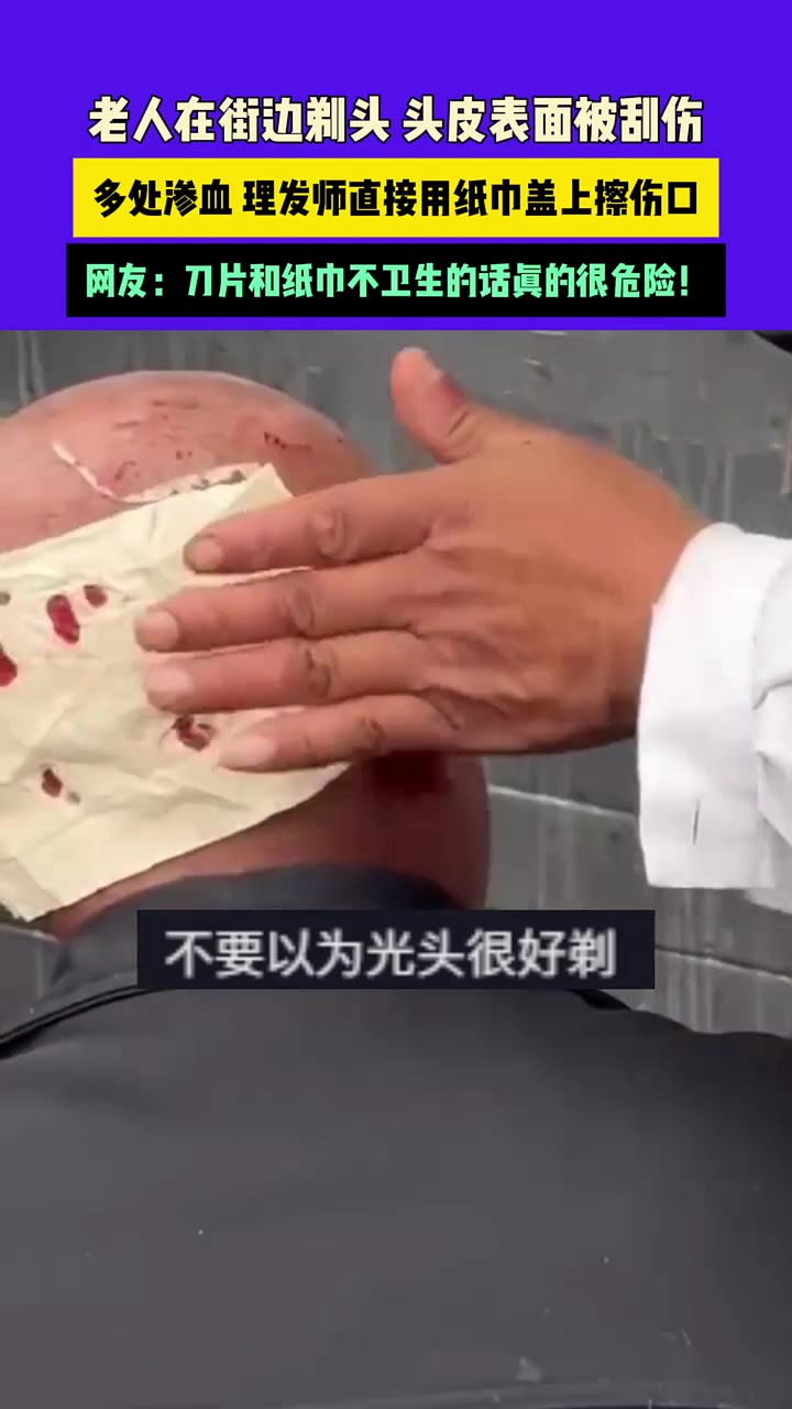 老人在街边剃头头皮表面被刮伤，多处渗血理发师直接用纸巾盖上