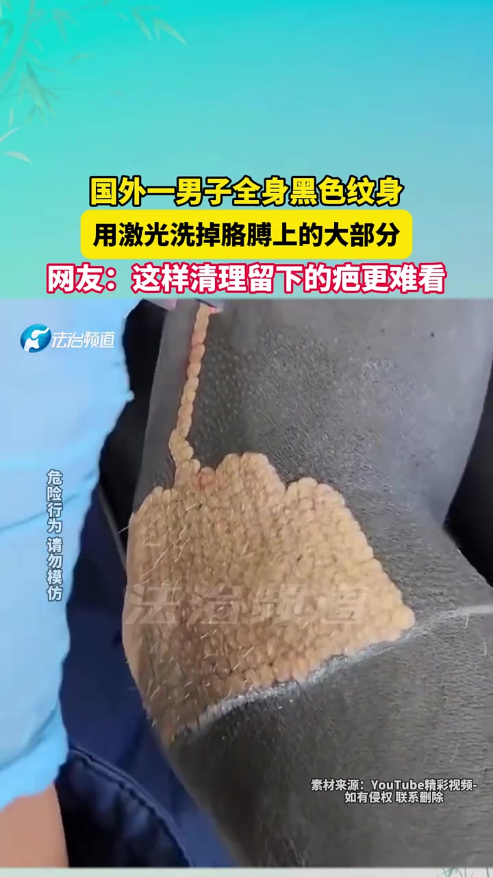 国外一男子全身黑色纹身，用激光洗掉胳膊上的大部分