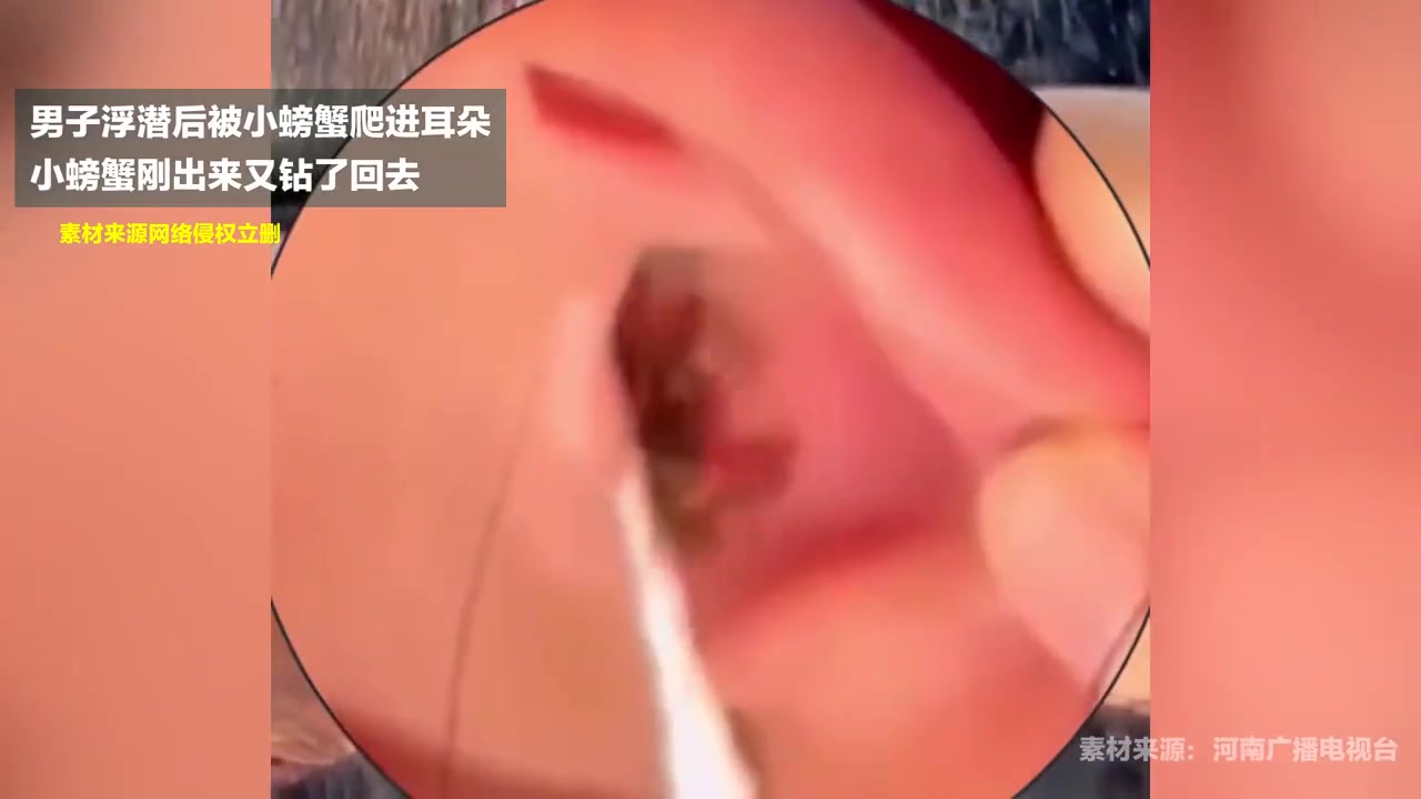 我出来了又进去了，你打我啊