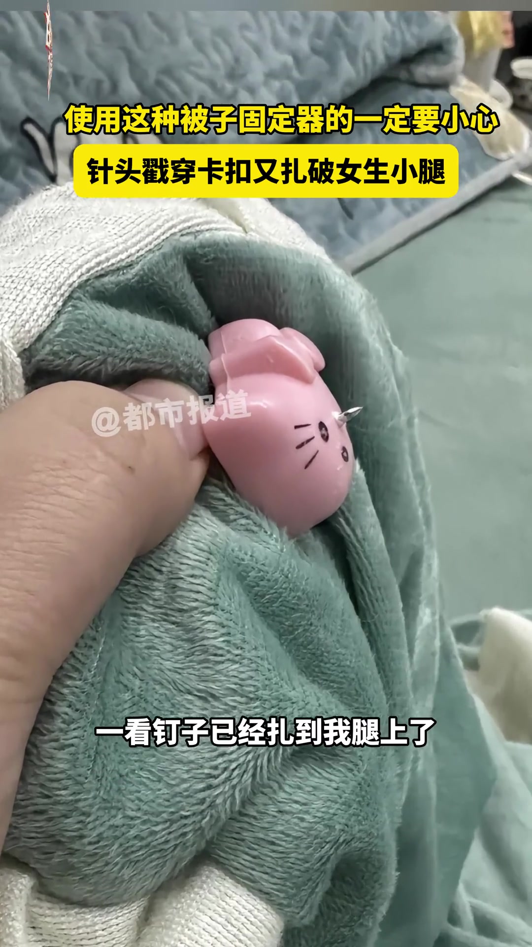 使用这种被子固定器的一定要小心，针头戳穿卡扣又扎破女生小腿