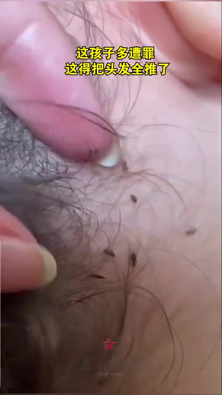 这孩子遭罪，头发全推了，这年头还长这东西！