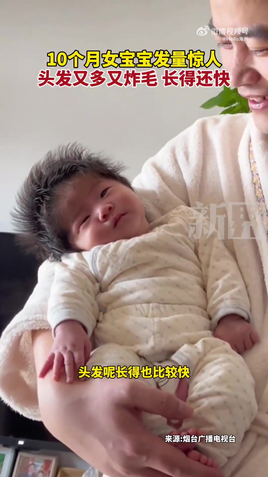 10个月女宝宝发量惊人，头发又多又炸毛，长得还快