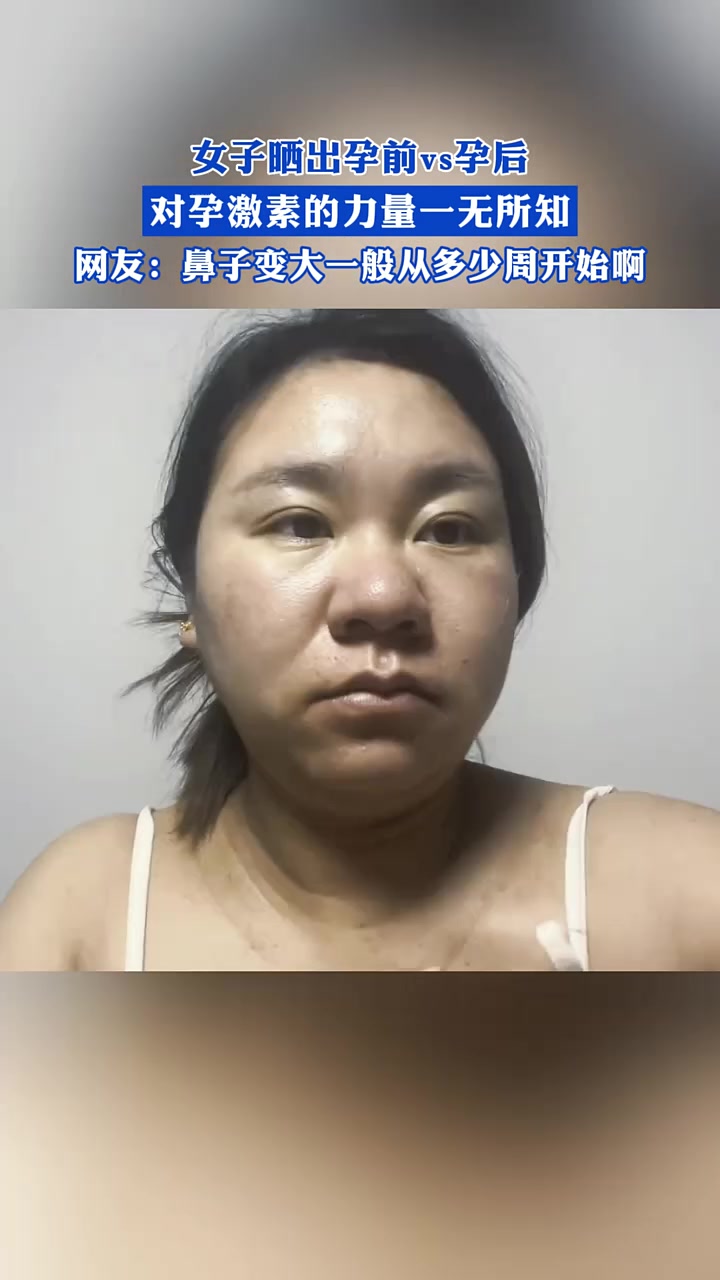 女子晒出孕前vs孕后，对孕激素的力量一无所知