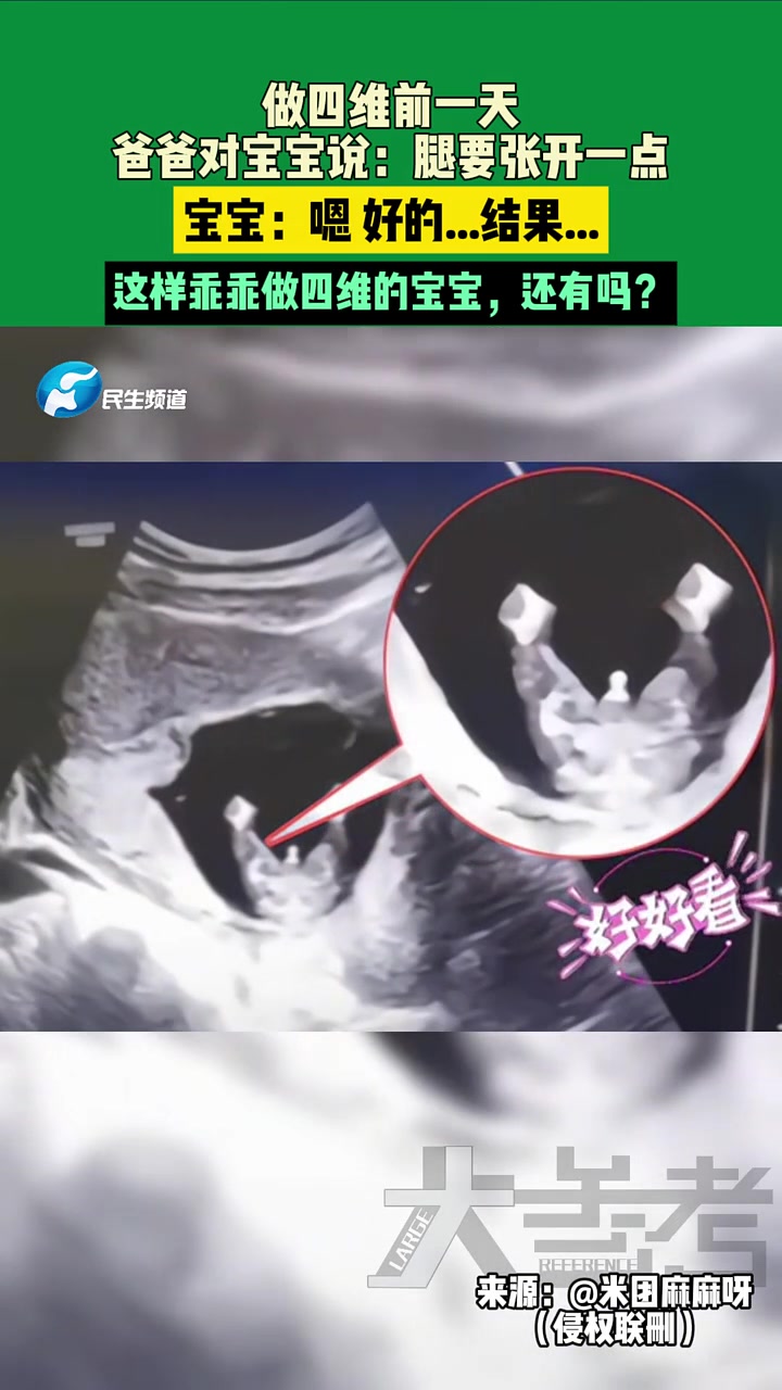 做四维前一天，爸爸对宝宝说：腿要张开一点...宝宝：嗯好的..