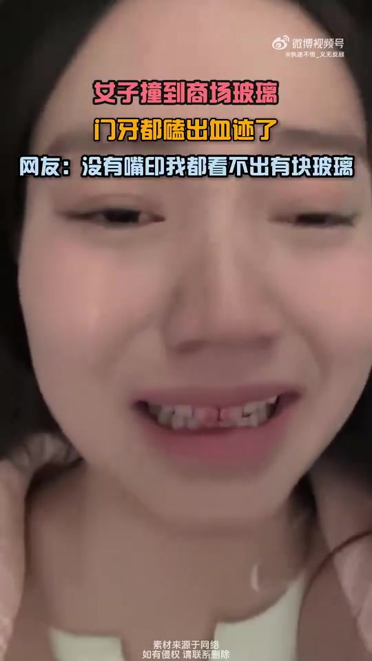 女子撞商场玻璃门牙出血，网友：看不出有玻璃
