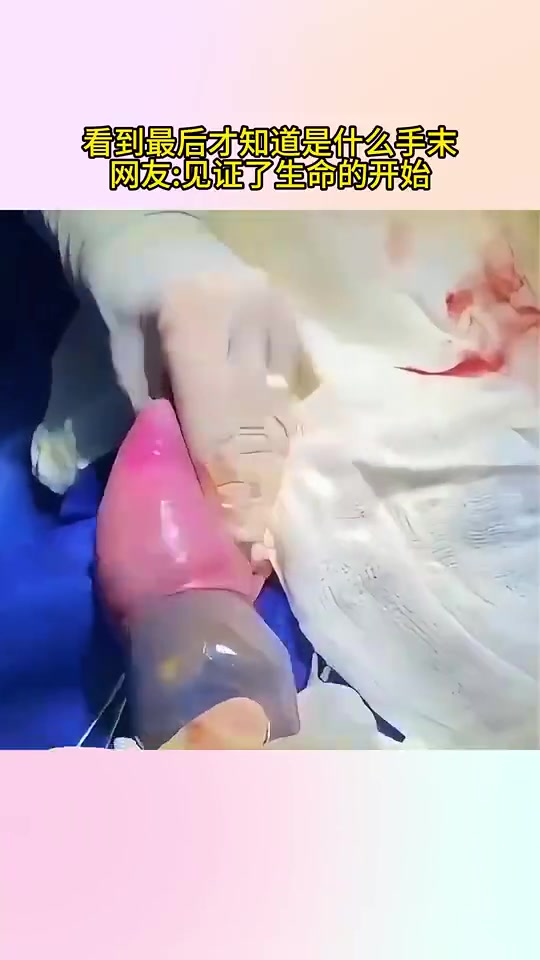 看到最后才知道是什么手术！