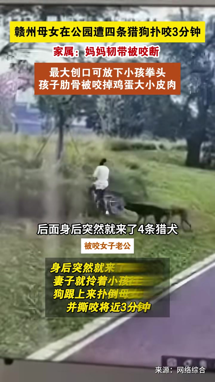 母女在公园造猎狗扑咬，伤势严重！！！