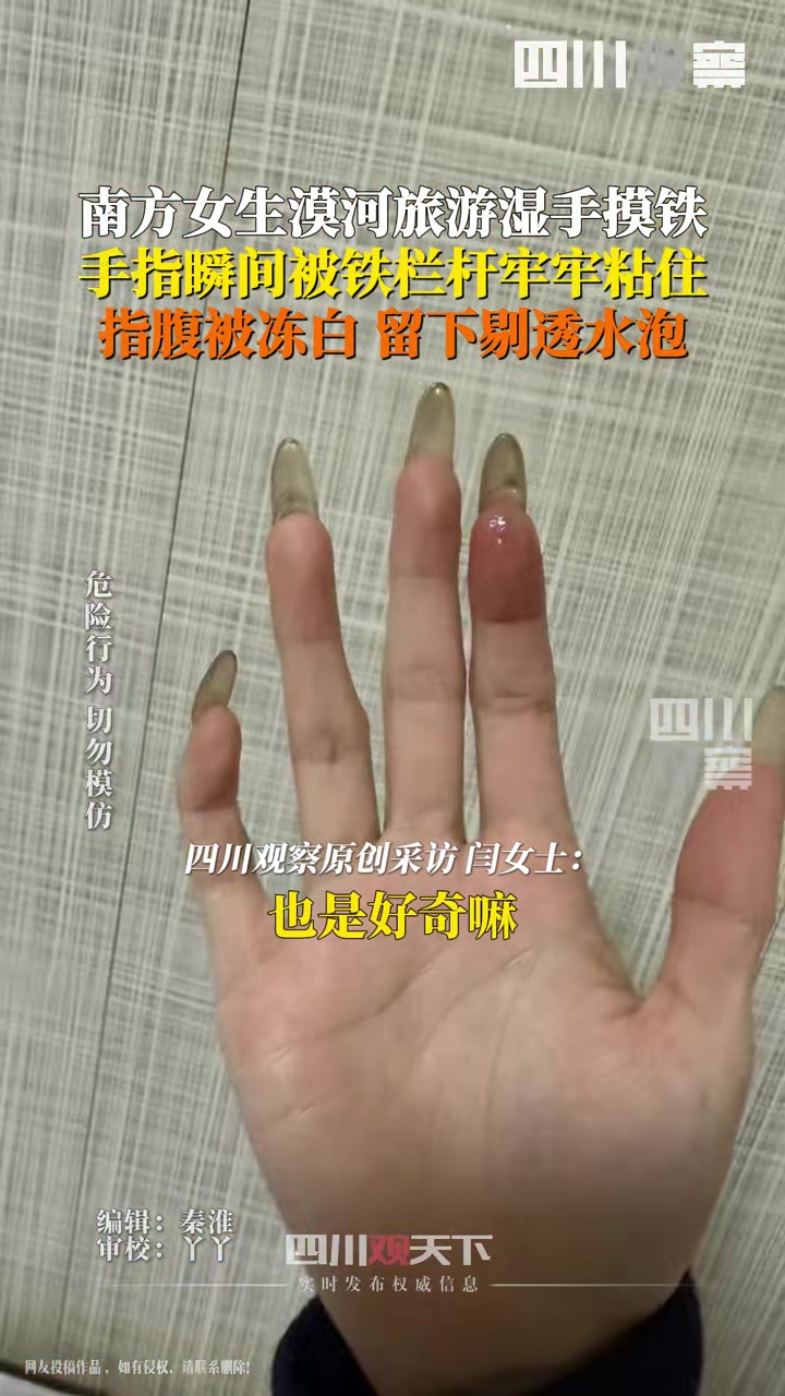女子漠河旅游湿手摸栏杆被粘牢
