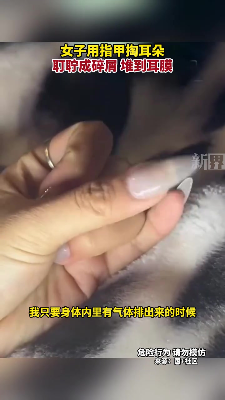 女子用指甲掏耳致耵聍成碎屑堆到耳膜