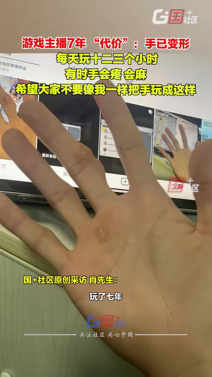 我朋友玩了十几年都不会这样，这是得痛风了吧