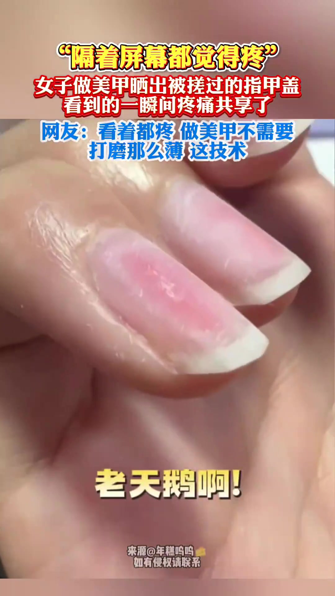 女子做美甲晒出被搓过的指甲盖，看到的一瞬间疼痛共享了