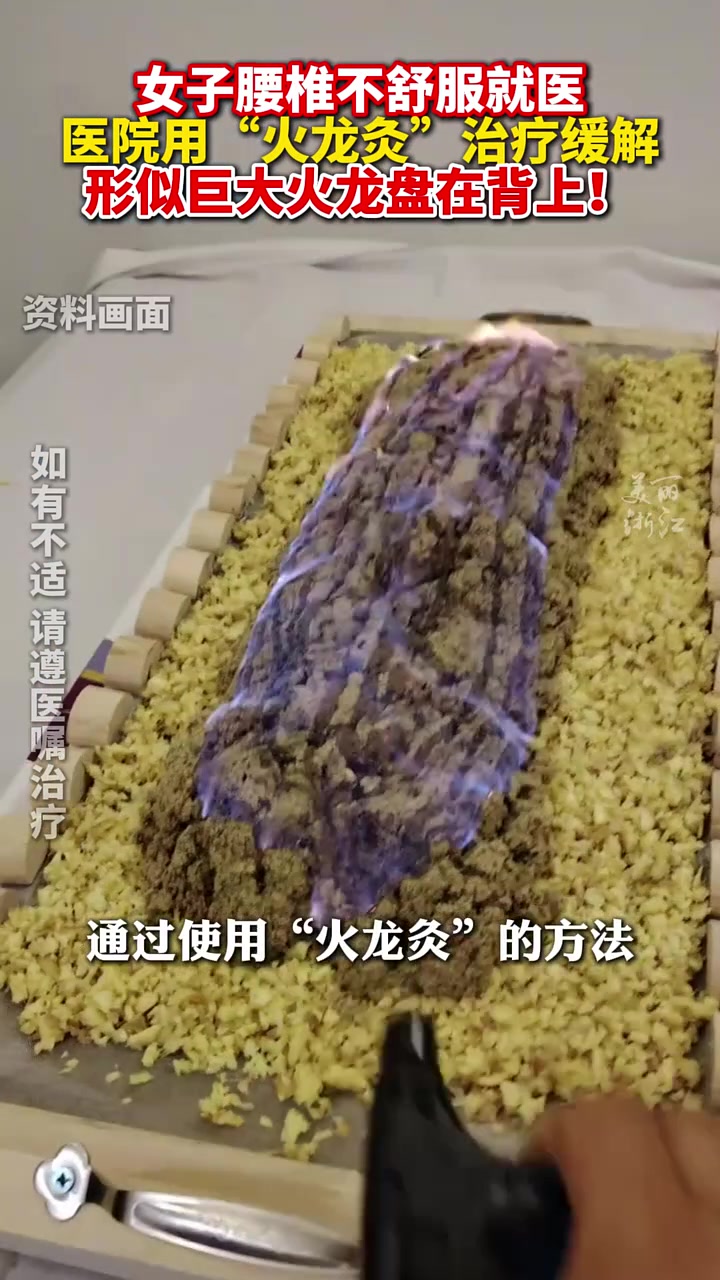 女子腰椎不适找中医做了火龙灸，医生：具有温经散寒作用！