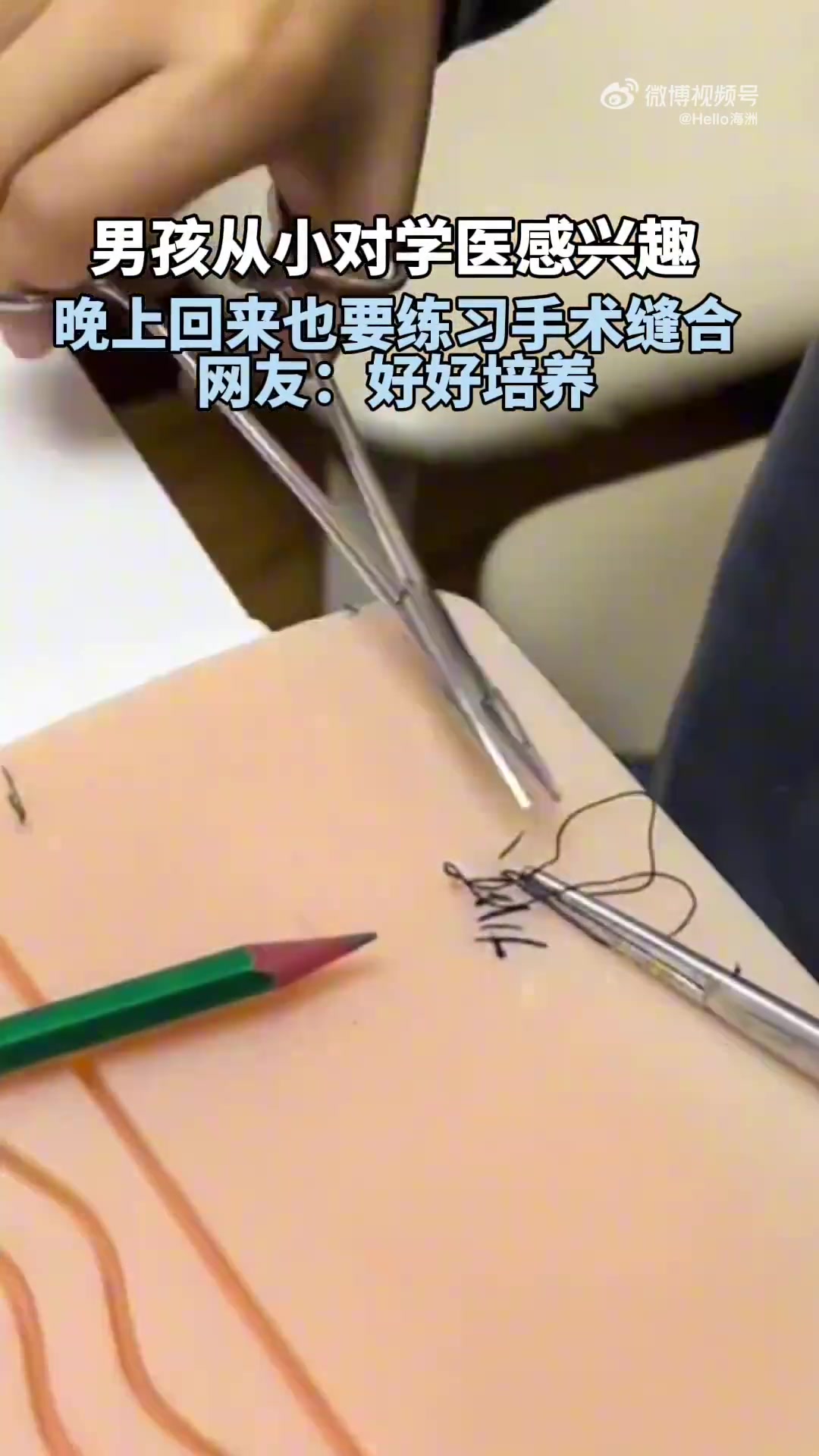 男孩从小对学医感兴趣，晚上回来也要练习手术缝合