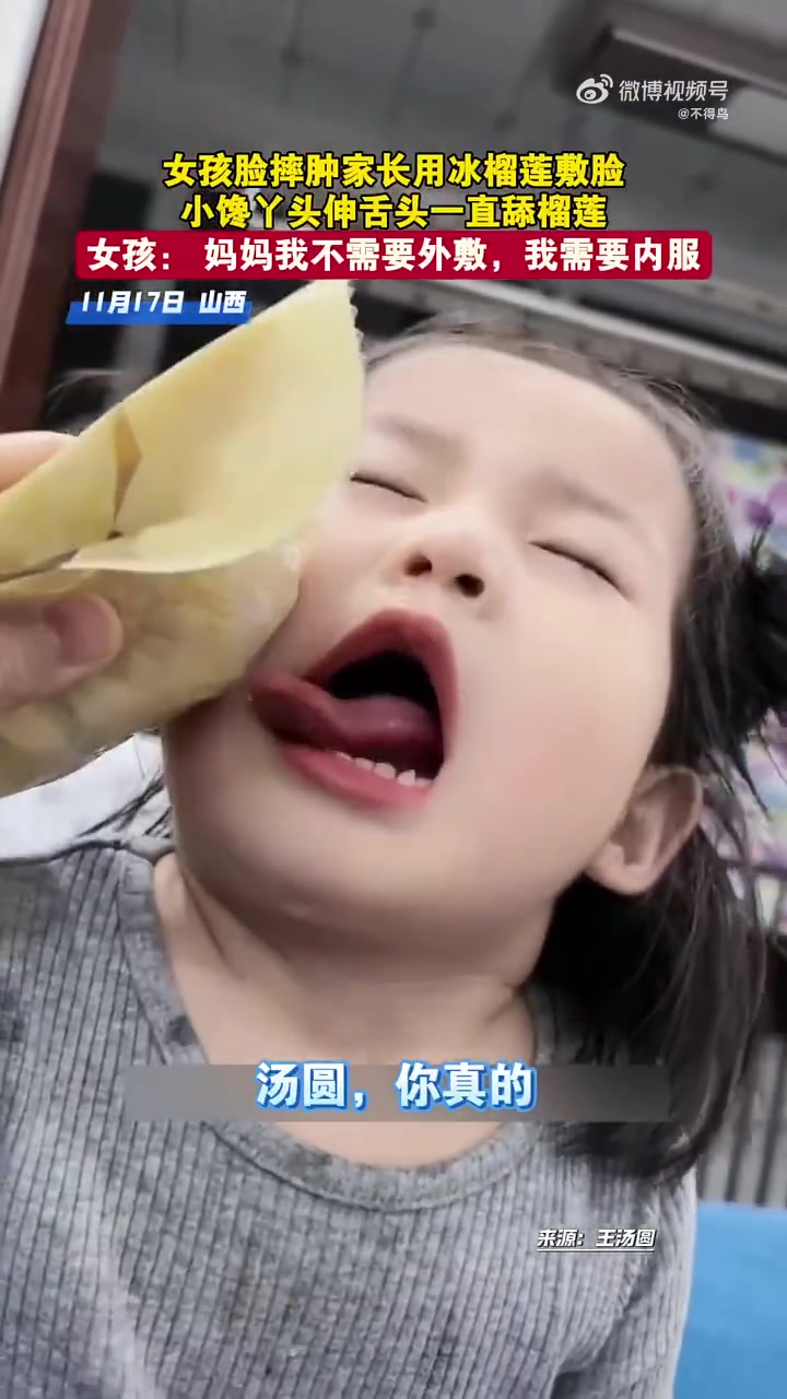 女孩脸摔肿，家长用冰榴莲敷脸，小馋丫头伸舌头一直舔榴莲