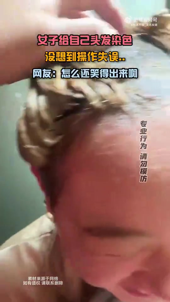 女子给自己头发染色，没想到操作失误网友：还笑得出来啊！