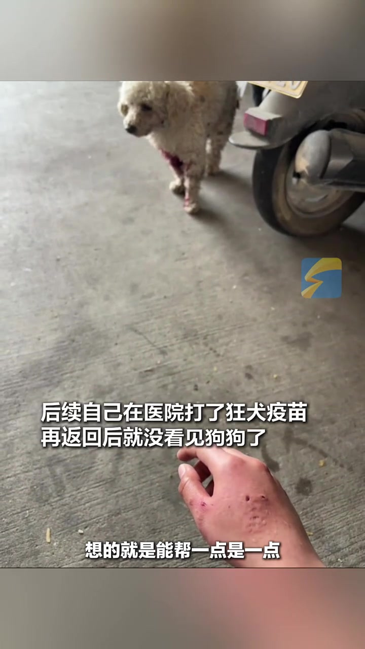 女子救助狗反被咬了一口，“世界上的狗狗被弃养挺可怜