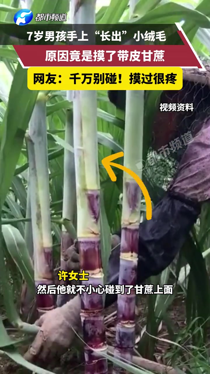 7岁男孩手上“长出”小绒毛，原因竟是摸了带皮甘蔗