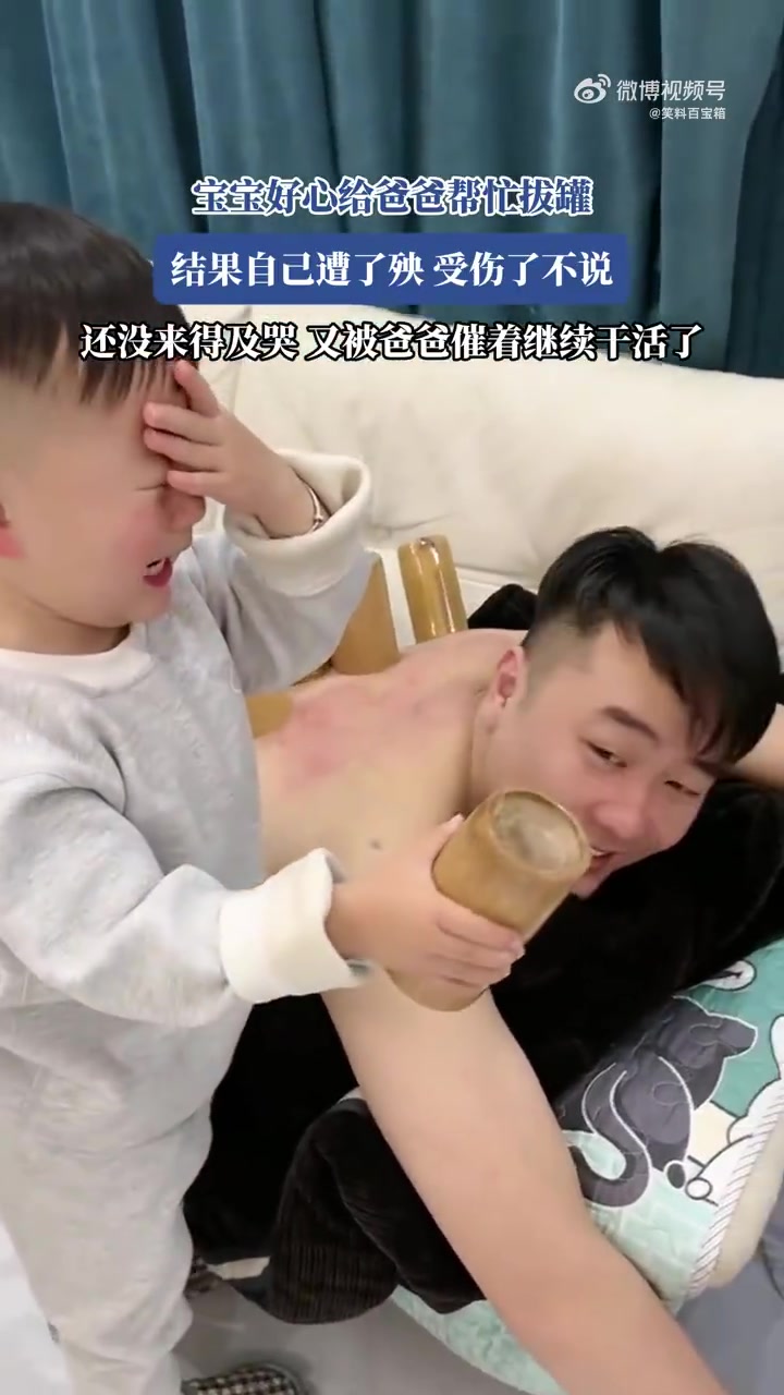 宝宝好心帮忙拔罐却遭殃，还被催着继续干活