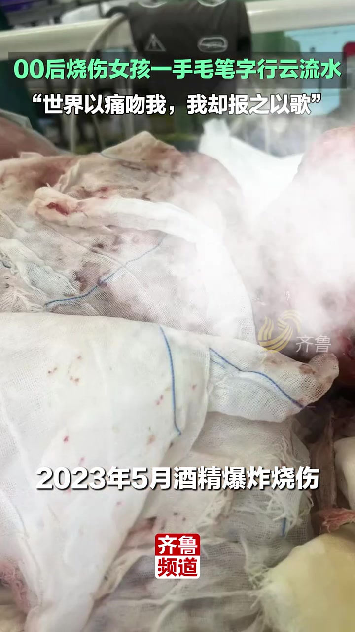 00后烧伤女孩一手毛笔字行云流水，“世界以痛吻我，我却报之以歌
