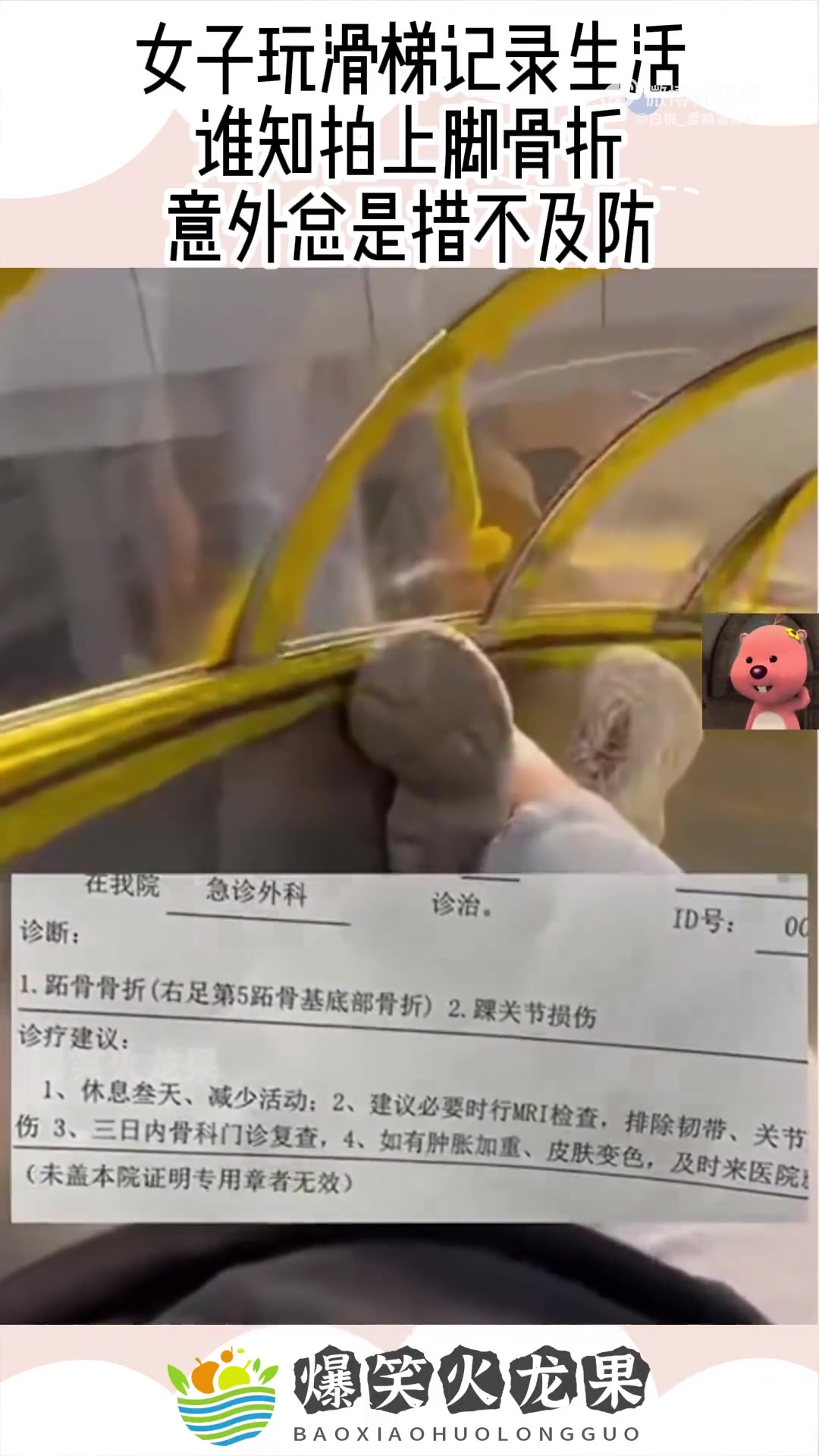 女子玩滑梯记录生活，谁知拍上脚骨折，意外总是措不及防！！