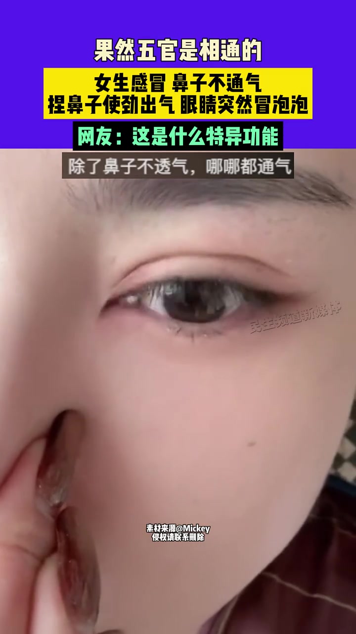 果然五官是相通的，女生感冒鼻子不通气，捏鼻子使劲出气眼睛冒泡