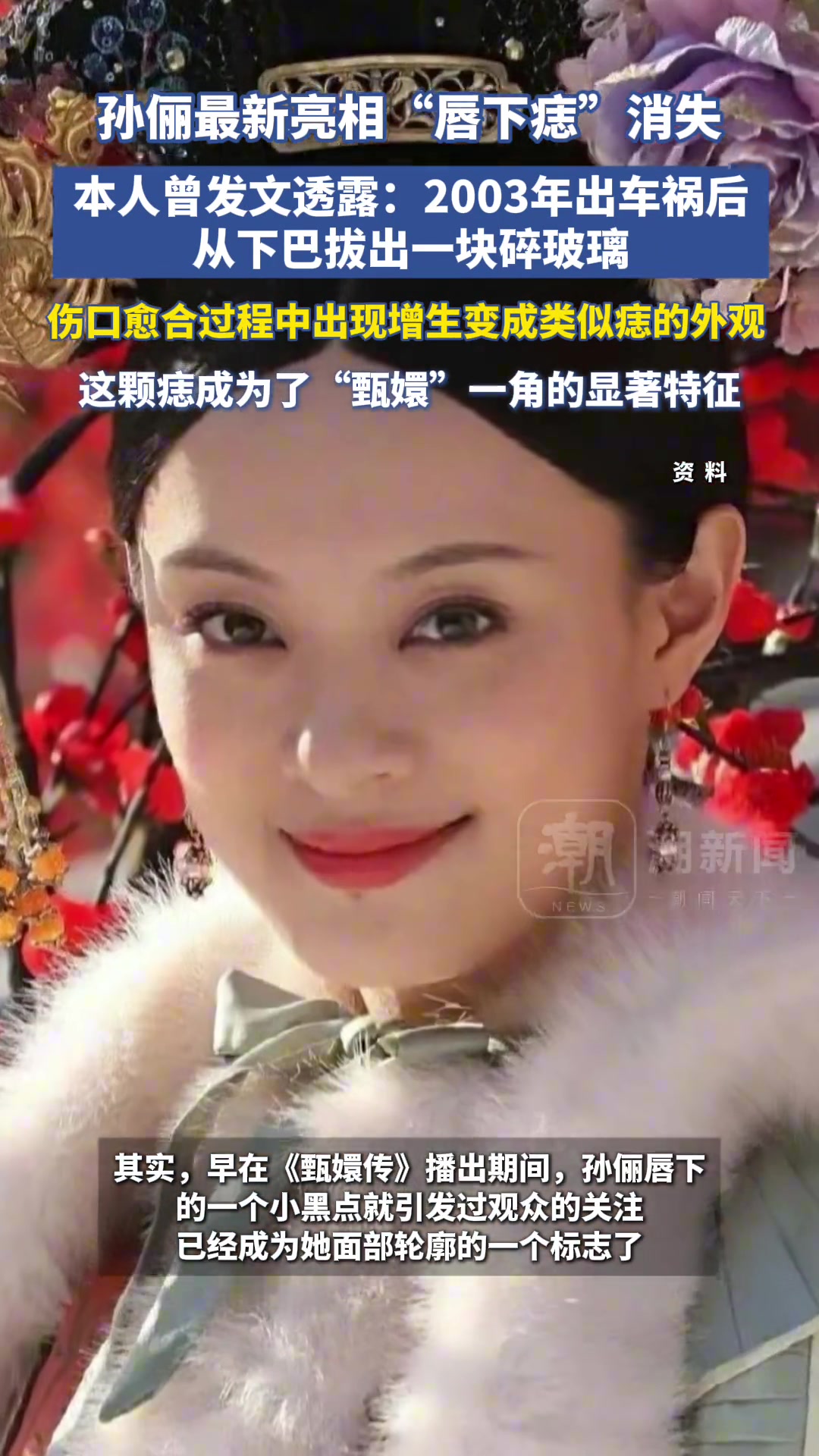 演员孙俪最新亮相唇下痣消失，引起热烈讨论