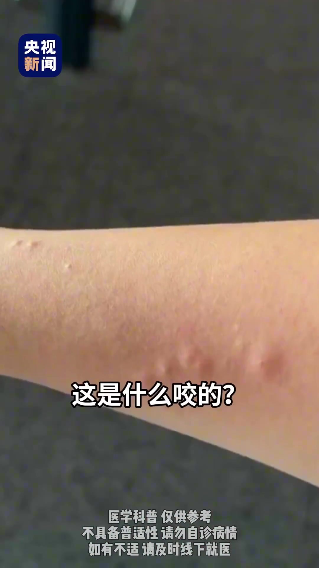 夏季防虫指南！对症用药建议转存
