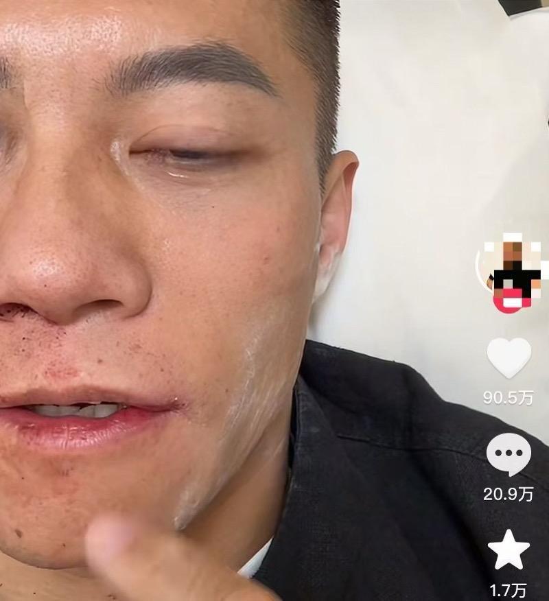 扇耳光大赛倒地的中国选手再谈失利:不后悔上场,坚定了决心