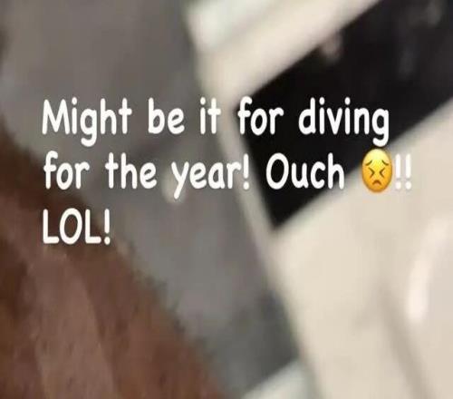 渗人！詹姆斯晒血肉伤口！真的太拼了.....