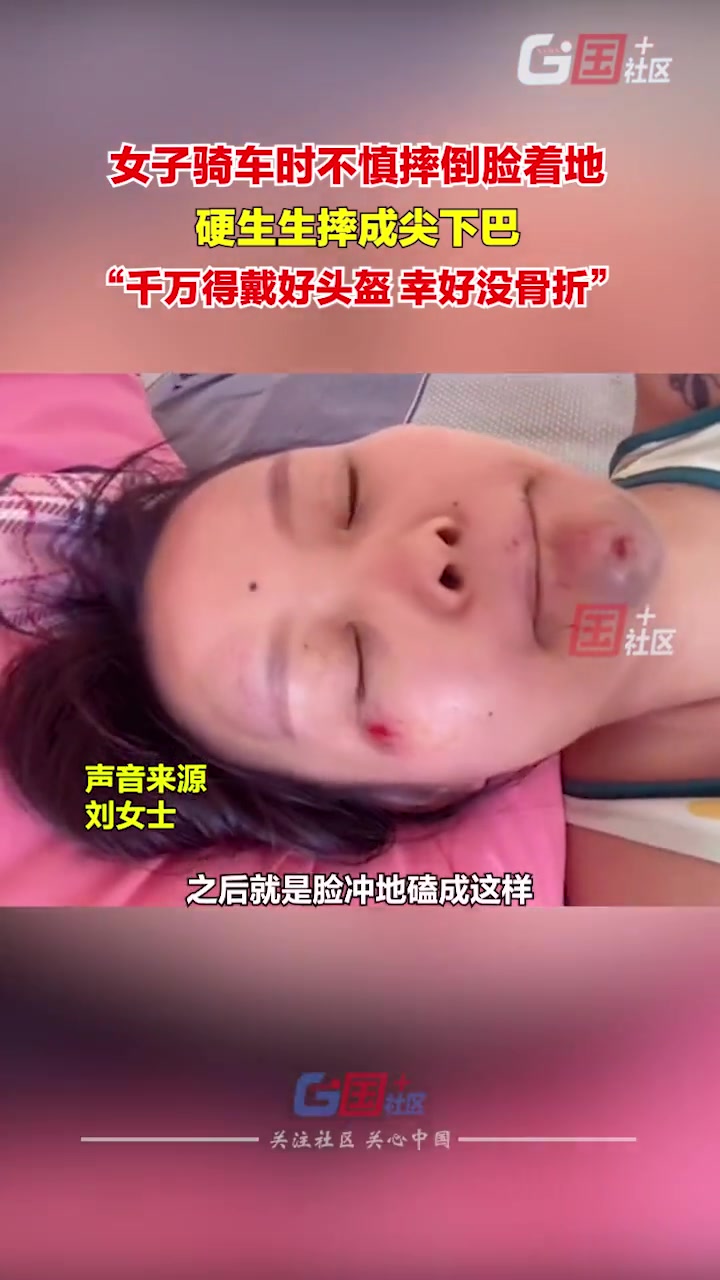 女子骑车拐弯时不慎摔倒 秒变“尖下巴”