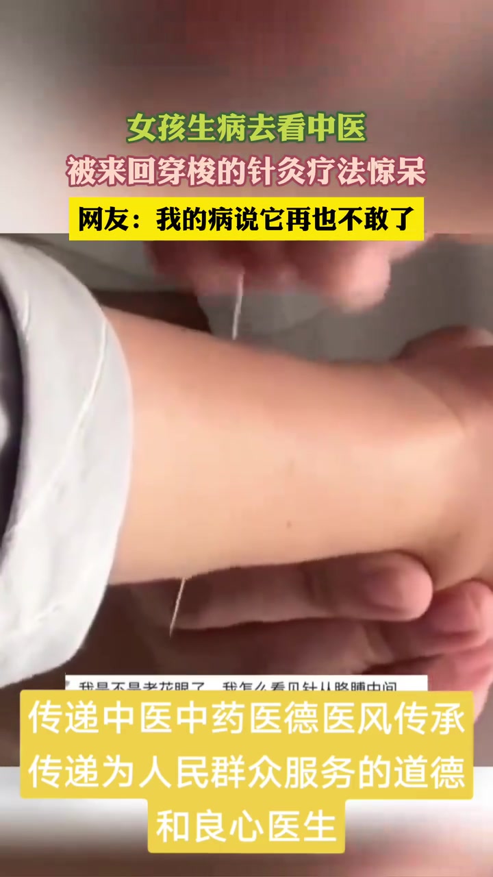 这针是穿透整个手臂吗？有知道的吧友说下吗？