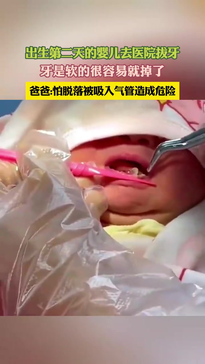 为什么新生儿会有牙齿啊？
