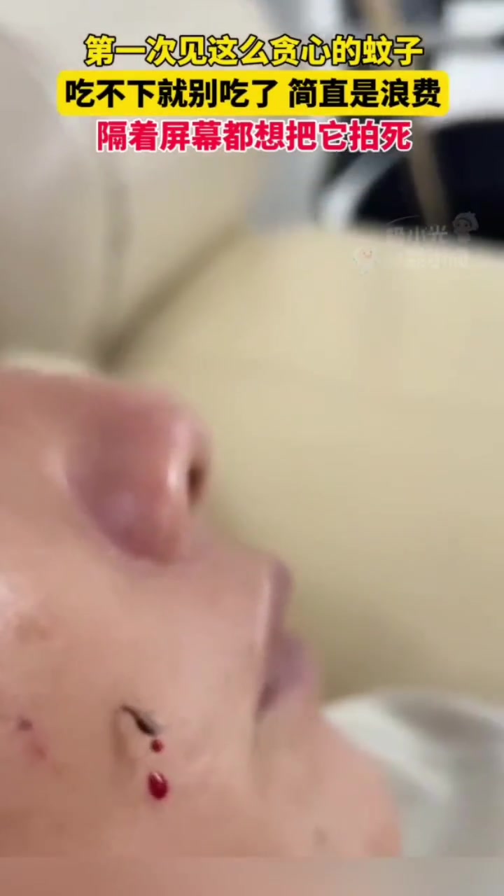 第一次见这么贪心的蚊子，吃不下就别吃了