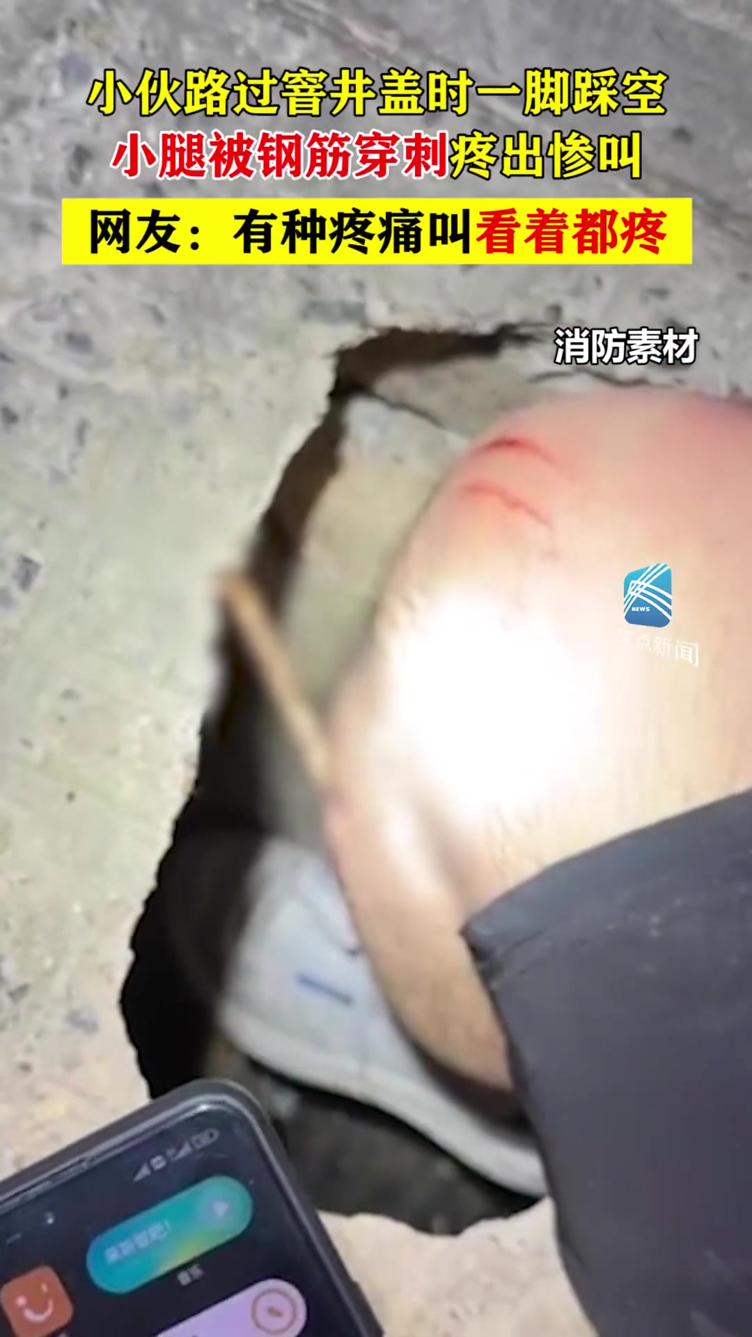 小伙路过窨井盖时一脚踩空 小腿被钢筋穿刺疼出惨叫