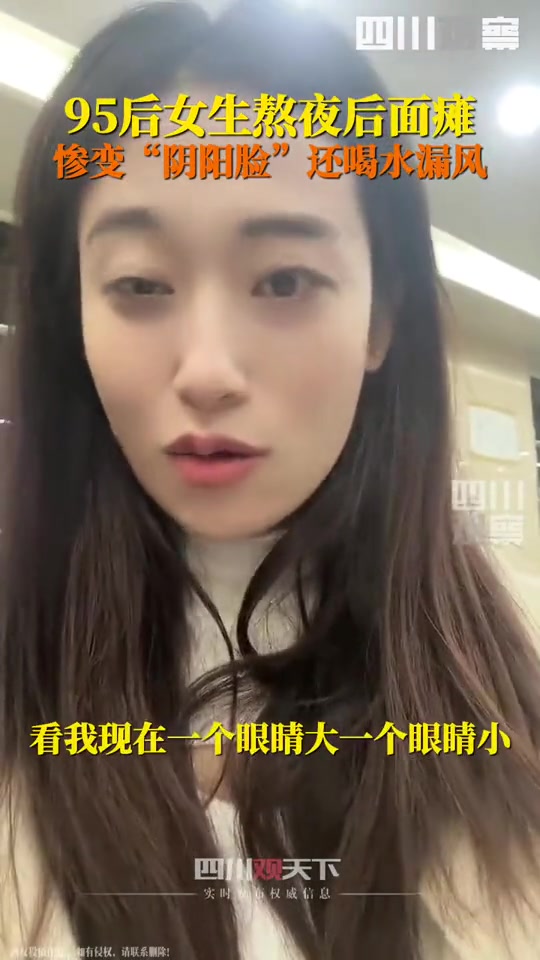 别再熬夜了！活生生的案例，熬夜面瘫，惨变“阴阳脸”